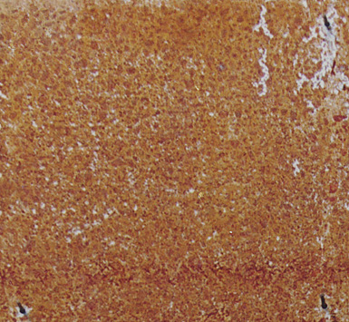 rusting